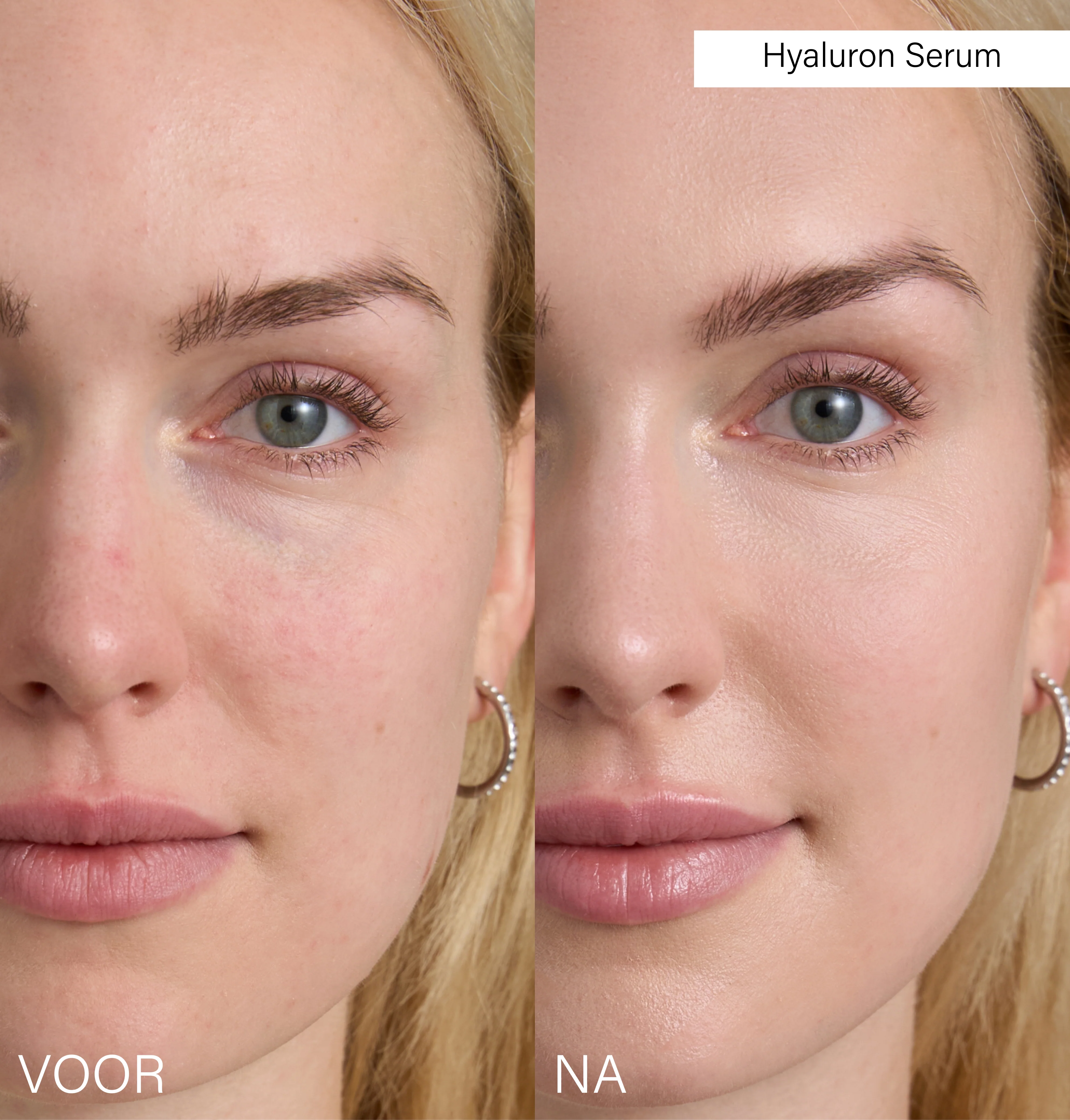 Hyaluron Serum - Image 3