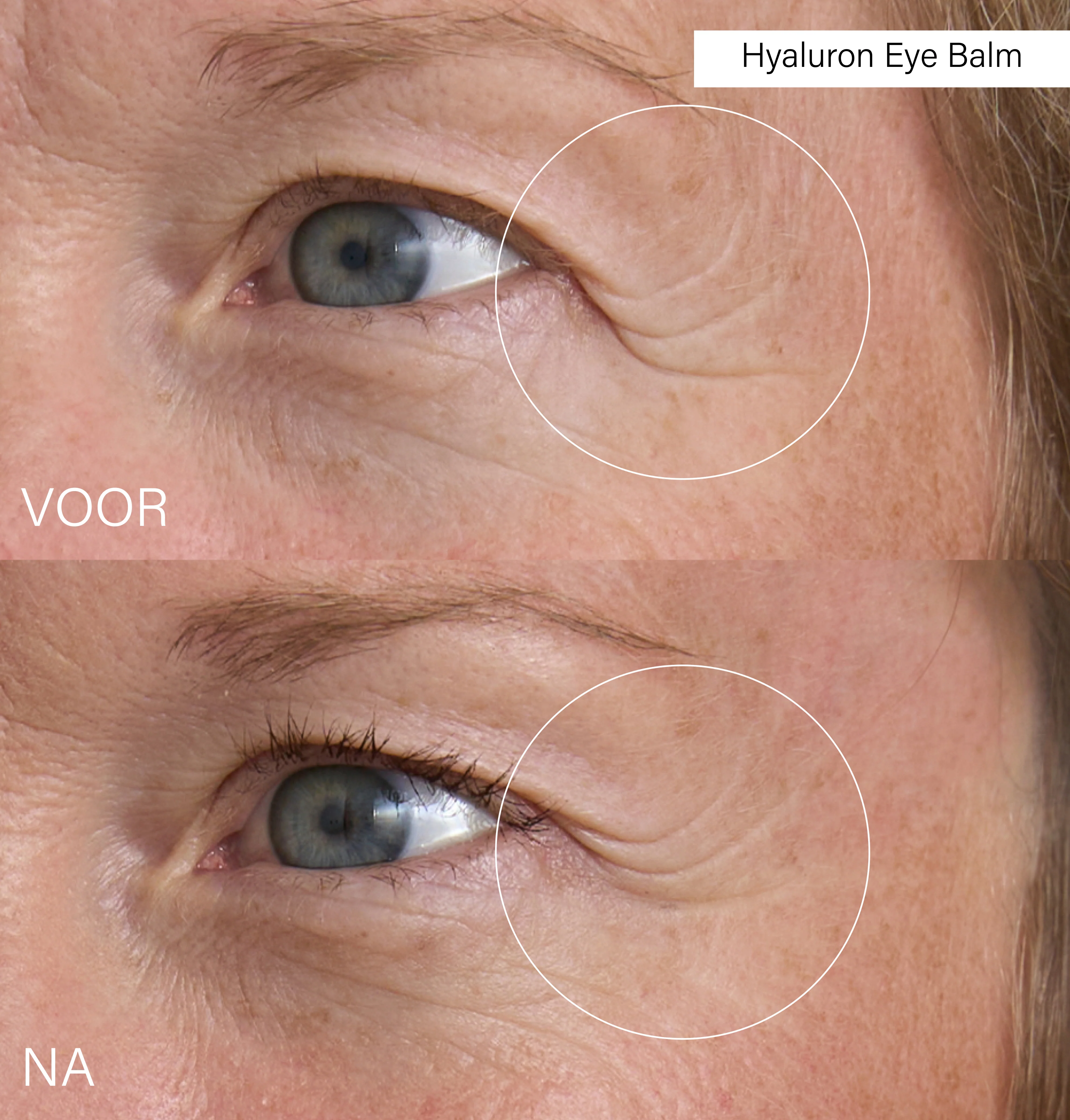 Hyaluron Eye Balm - Image 3